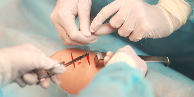 Skin Cancer Surgery