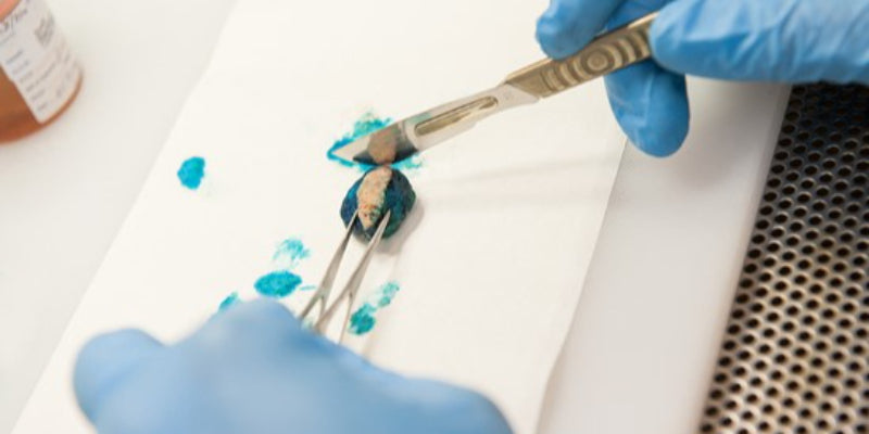 Specimen processing: Does the type of biopsy make a difference? Correlation cases (Nurse)